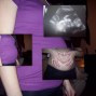 Фотографии животиков на 22-й неделе беременности