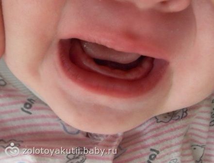 Как вылазят клыки у детей