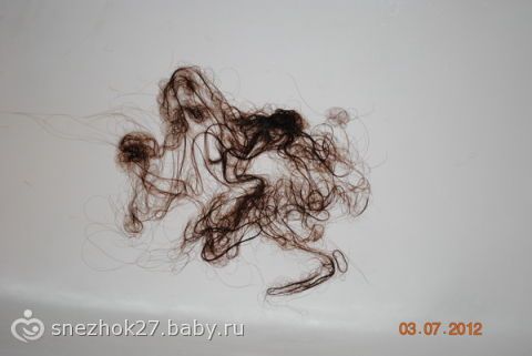 Алопеция причины почему у женщины при климаксе начинают выпадать волосы