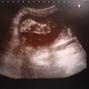 Фотографии УЗИ на 29-й неделе беременности