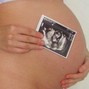 Фотографии животиков на 32-й неделе беременности