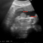 Фотографии УЗИ на 32-й неделе беременности