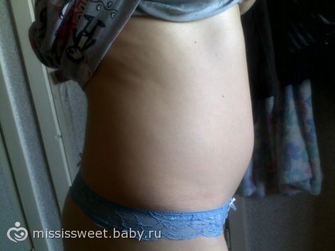 ГУЗ "Липецкий областной перинатальный центр" Вопрос: Коричневые выделения, срок беременности 6 недель.?