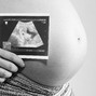 Фотографии УЗИ на 33-й неделе беременности