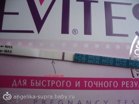 Окоча Виктория Александровна акушер-гинеколог ПЦ Форум Нюансы спаривания и родов сибирской кошки