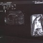Фотографии УЗИ на 23-й неделе беременности