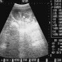 Фотографии УЗИ на 12-й неделе беременности