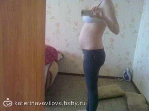 Причины появления геморроя у беременных