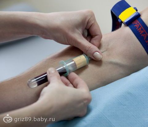 Отеки ног при варикозе лечение