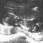 Фотографии УЗИ на 14-й неделе беременности