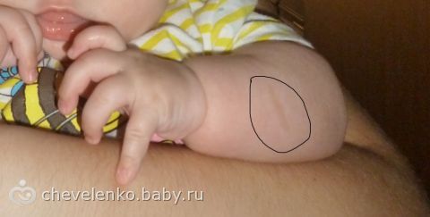 Правда ли что отбеливает кожу