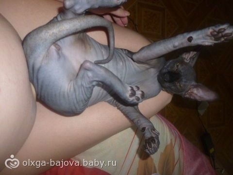 лишний сосок.